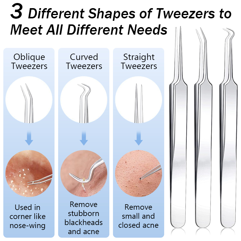 Stainless Steel Acne Blackhead - đánh giá và giá Luxury Skincare Acne