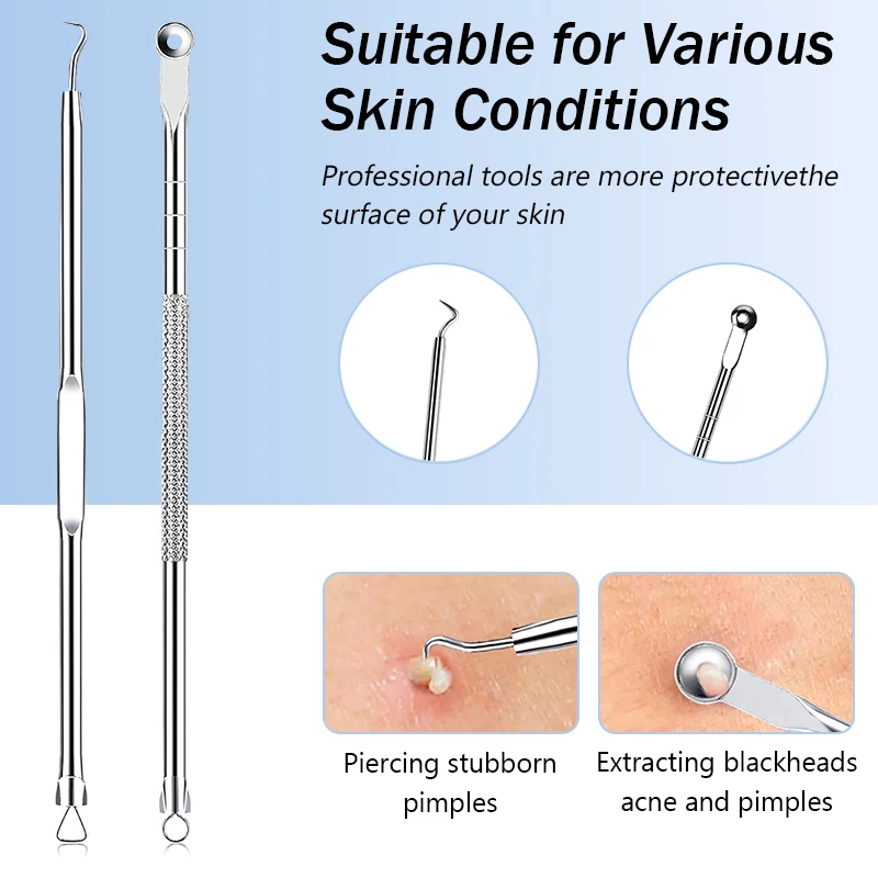 Stainless Steel Acne Blackhead - đánh giá và giá Luxury Skincare Acne