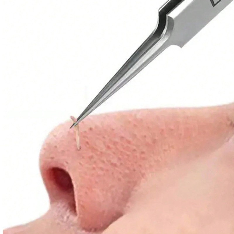 4/6PCS Face Cleaning Kit Pimpl - đánh giá và giá Luxury Skincare Acne