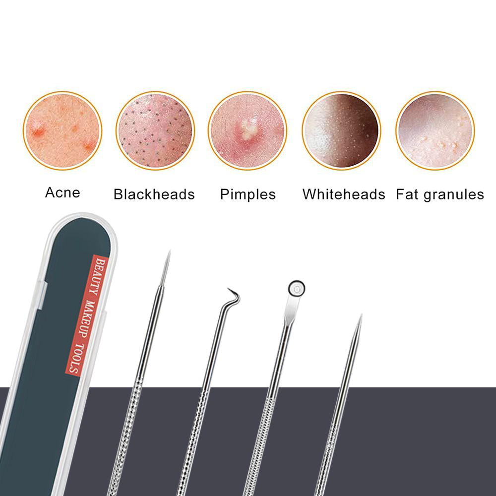 Pimple Popper Tool Kit Blackhe - đánh giá và giá Luxury Skincare Acne