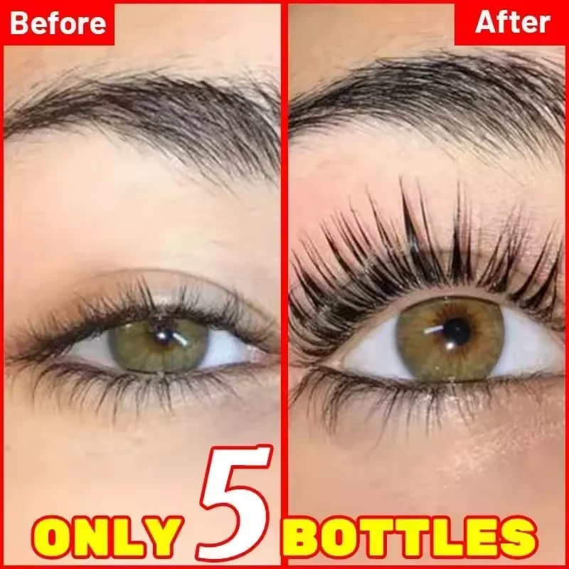 7 Days Fast Eyelash Growth Ser - đánh giá và giá Growth Factor Serum