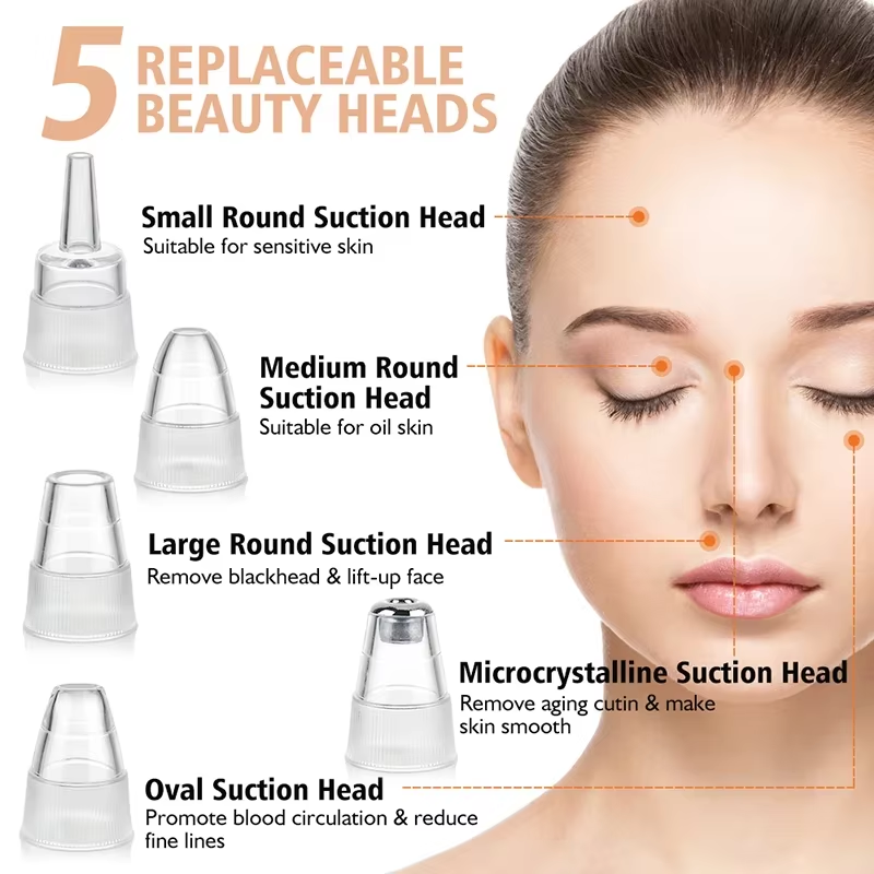 Blackhead Remover Vacuum Sucti - đánh giá và giá Luxury Skincare Acne