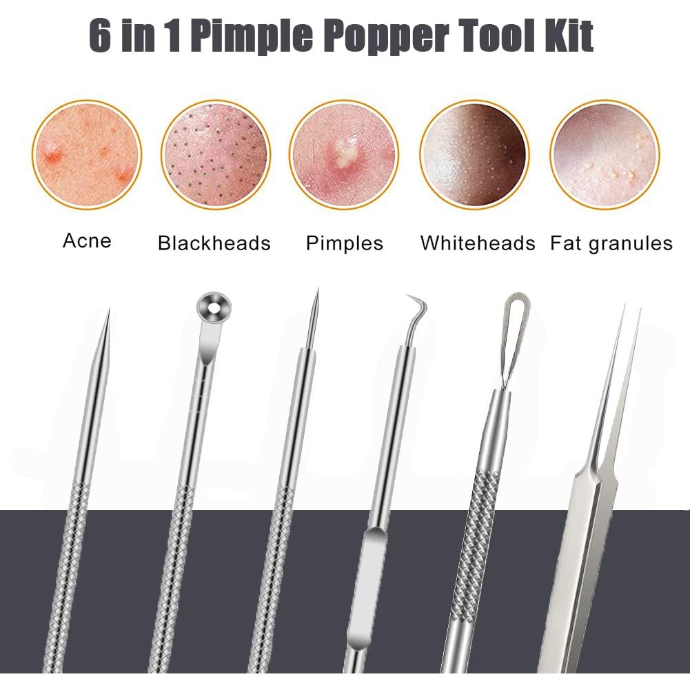6PCS Pimple Removal Tool Black - đánh giá và giá Luxury Skincare Acne