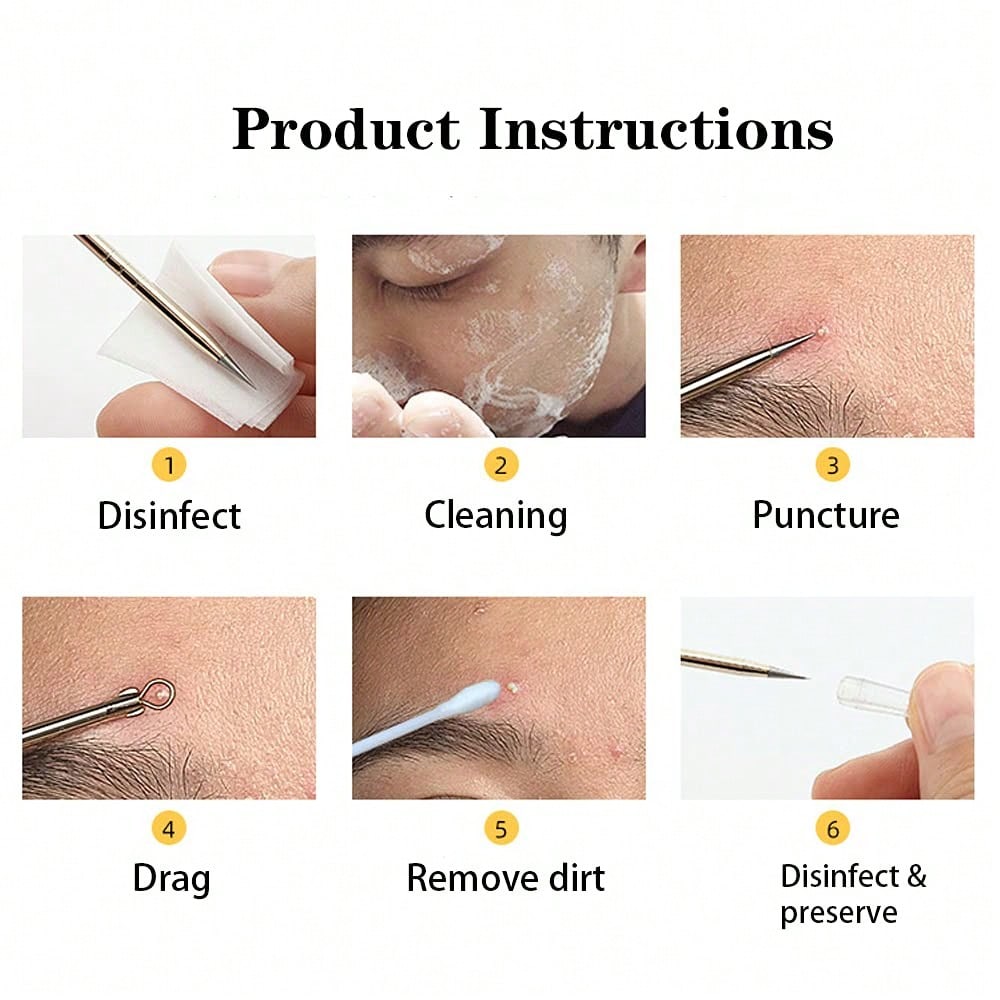 4-piece stainless steel comedo - đánh giá và giá Luxury Skincare Acne