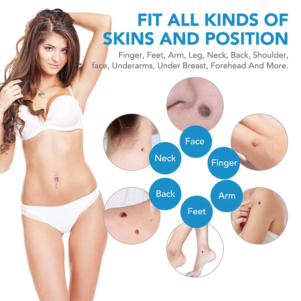 Auto Skin Tag Removal Tool Kit - đánh giá và giá Luxury Skincare Acne
