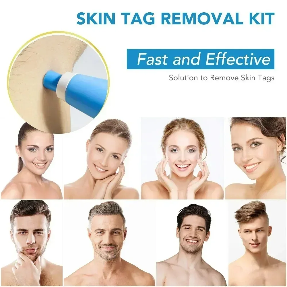 Acne Remover 2 IN 1 Auto Micro - đánh giá và giá Luxury Skincare Acne