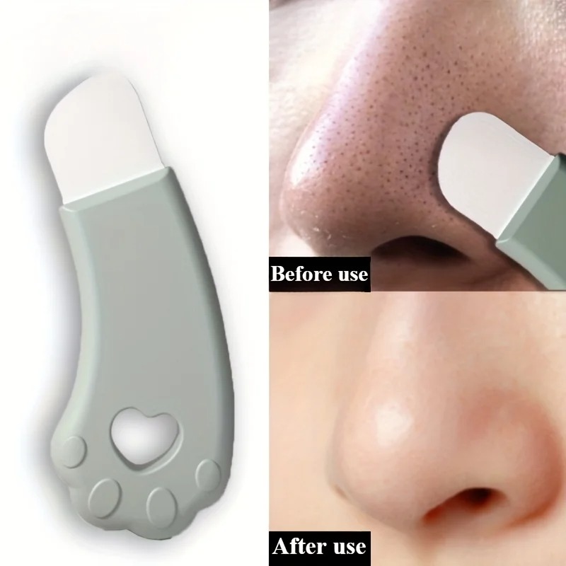 Cat Paw Blackhead Remover Tool - đánh giá và giá Luxury Skincare Acne