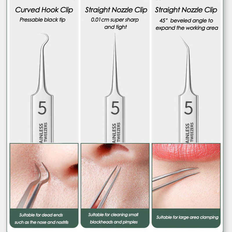 Acne Blackhead Removal Needles - đánh giá và giá Luxury Skincare Acne